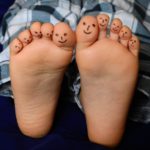 peus_saludables-clinicamartimaset
